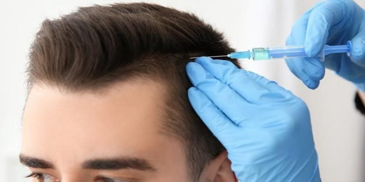 hair transplant in jaipur
