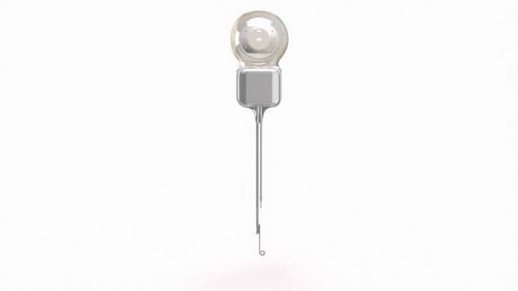 Cochlear Nucleus Nexa implant represents a significant advancement | JustPicked Cochlear Nucleus Nexa implant represents a significant advancement