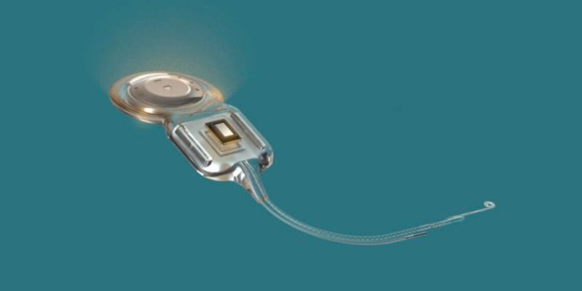 Close-up of a cochlear implant component, showing the processor unit with a curved wire/lead extending to the right on a teal background (medical device).