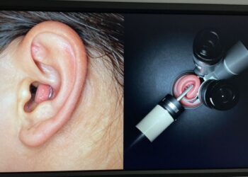 Endoscopic and microscopic views of ear surgery.