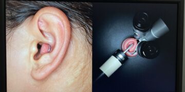 Endoscopic and microscopic views of ear surgery.